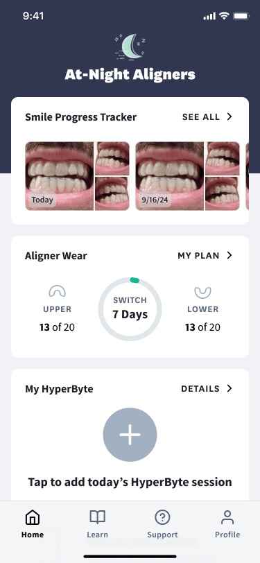 Smile Progress Tracker